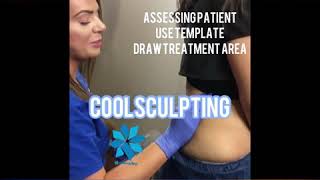 Coolsculpting Flanks ❄️ [upl. by Ruthven678]