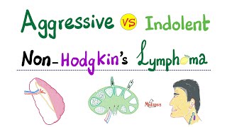 NonHodgkins Lymphoma  Aggressive type VS Indolent type  Hematology and Oncology [upl. by Svend]