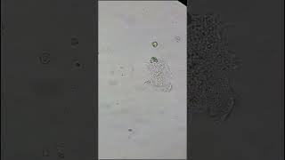 An amoeba timelapse now in 4k microscope microscopiclife microscopy nature [upl. by Okramed]