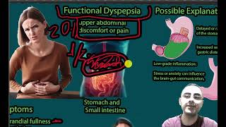 Functional Dyspepsia Upper Abdominal pain Epigastric pain Symptoms causes and treatment [upl. by Zeugirdor]