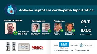 Ablação Septal em Cardiopatia Hipertrófica [upl. by Dulla]