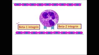 MOTD6case6 IOTDcase6 INFLAMMATIONCELLULAR EVENTS [upl. by Anivek]