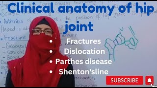 Clinical anatomy of hip joint  fractures dislocations perthes disease Shentons line lower limb [upl. by Melita]