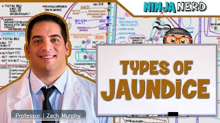 Gastrointestinal  Types of Jaundice [upl. by Adiraf]