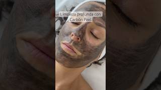 Limpieza facial profunda con Carbón peel [upl. by Duer]