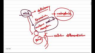 General Pathology Class 7 Mechanism of Metaplasia Dr Murtoza Shahriar [upl. by Sirotek]