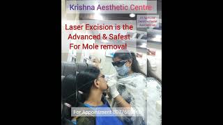 Do you know moles occur due to human Papilloma Virus  Contact your Doctor soonmoleremoval [upl. by Iggam]