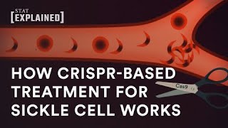 New CRISPRbased sickle cell treatment explained [upl. by Pax]