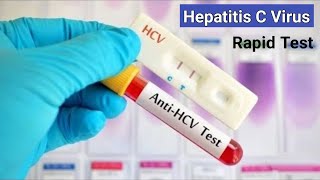 Hepatitis C Rapid Test  কিভাবে হেপাটাইটিসসি ভাইরাস পরীক্ষা করা হয়  AntiHCV RDT Test [upl. by Zilef]