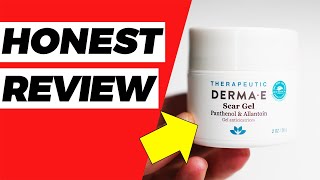 Derma E Scar Gel Review Link Below 👇 [upl. by Ahsyekat819]