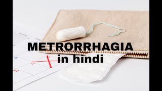 Metrorrhagia in Hindi obsgyne abnormal uterine bleeding mbbsstudy obsgyne [upl. by Erdna879]