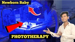 Phototherapy Treatment For Jaundice  Phototherapy In Newborn newborn baby phototherapy [upl. by Rhoades]