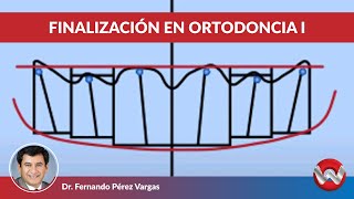 Finalizacion en ortodoncia parte I [upl. by Loydie]