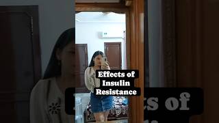 insulinresistance diabetesawareness insulinsensitivity healthtips girl shorts reels sugar [upl. by Eikkin395]