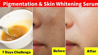 She applied👆🏼Skin Clearing Serum For Pigmentation and Skin Whitening for 7 Days Skin Transformation [upl. by Creigh940]