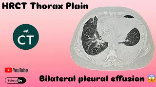 How to make filming  HRCT Thorax Plain  Ge 32 revolution [upl. by Nasar]