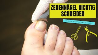 ZEHENNÄGEL RICHTIG SCHNEIDEN  So geht es richtig [upl. by Froehlich949]