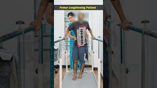 Femur Lengthening Surgery  Physiotherapy Session  Height increase Surgery [upl. by Alick945]