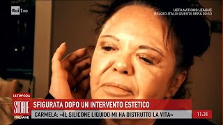 Chirurgia e medicina estetica i rischi del fai da te  Storie italiane 14112024 [upl. by Eedya]