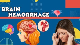 Explain Brain Hemorrhage Hemorrhagic Stroke  CausesSymptoms and TreatmentBleeding in the Brain [upl. by Groveman]