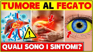 5 Segni e Sintomi Del Tumore Al Fegato  Non Ignorare Questi Sintomi [upl. by Oberon770]