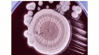 Identification of Filamentous Fungi Hyaline Monomorphic Fungi Part 4 Hot topic [upl. by Anaujait]