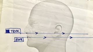 How To Take An Odontoid View XRay  Perfectly  Every Time [upl. by Uohk]