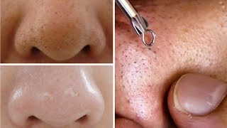 How To Do Facial Clean Up At Home Step By Step For Spotless Clear Skin Rabia Skincare [upl. by Imyaj]