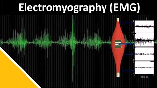 EMG Electromyography in Biomechanics  Delsys [upl. by Laehcimaj]