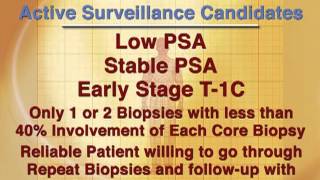 Prostate Cancer Treatment 07 Observation amp Surgical Approaches [upl. by Ulysses]