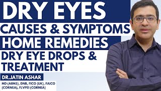 Dry Eyes  Dry Eyes Symptoms  Dry Eye Home Remedy  Dry Eye Treatment  Eye Drops [upl. by Bobbe494]