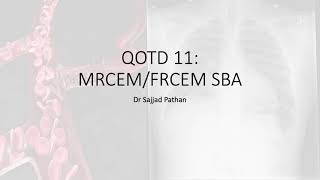 Question of the Day 11 MRCEMFRCEM SBA SLO1 Sickle Cell Disease [upl. by Rednazxela89]