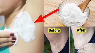 UNDERARMS WHITENING AT HOME Hindi  अंडरआर्मस का कालापन 5 मिनट में दूर करें  100 Effective [upl. by Ahsiuqat870]