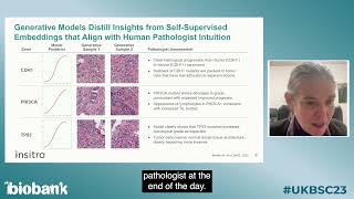 S214 Using histopathology to power discovery  UK Biobank Scientific Conference 2023 subtitles [upl. by Estella821]