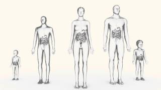 UIcerative Colitis 101 [upl. by Ajiram]