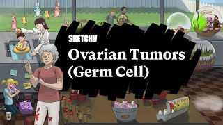 Ovarian Germ Cell amp Stromal Tumors Part 1  Sketchy Medical  USMLE Step 1 [upl. by Yretsym]