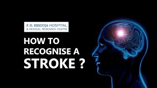 How to recognize a stroke  Dr Darshan Doshi [upl. by Quintessa669]