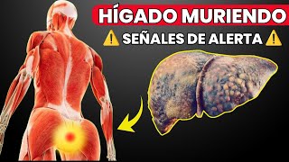 13 Signos Extraños de DAÑO en el HÍGADO [upl. by Nytsuj736]