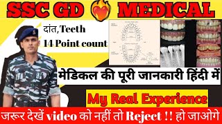 SSC GD MEDICAL 2023 SSC GD Danton ka medical  दांत का मेडिकल कैसे होता है  Dental medical test [upl. by Dituri]