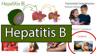 Hepatitis B symptoms treatment and prevention [upl. by Ellehsem225]