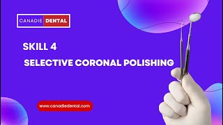 Skill 4Selective Coronal Polishing [upl. by Eimac]