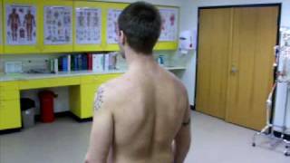 Scoliosis Test [upl. by Robet]