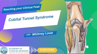 Cubital Tunnel Syndrome [upl. by Alegna189]