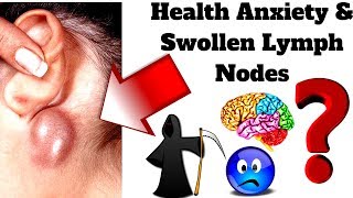 Health Anxiety amp Swollen Lymph Nodes [upl. by Mages698]