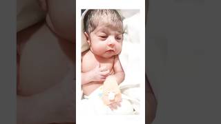 Cute Neonatal baby admit in nicu nicu doctor hospital 🏥🏥🏥 subscribemychannel 🙏🙏🙏 [upl. by Onaicul]