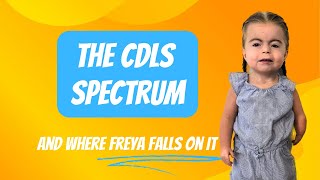 Is she severely affected Looking at the CdLS spectrum [upl. by Lamaaj]