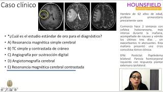 casos clinicos de neuro imagen parte 3 [upl. by Moia768]