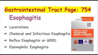 Esophagus Lecture 2 ESOPHAGITIS AND GERDROBBINS AND COTRAN [upl. by Yecak194]