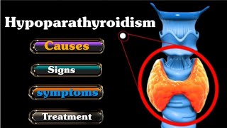 Hypoparathyroidism  Causes  Symptoms  Diagnosis  Treatment ll in Hindi endocrinesystem [upl. by Yeliab]