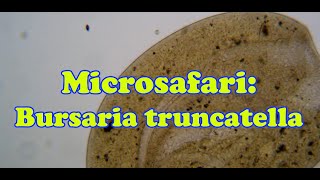 Microsafari Bursaria truncatella [upl. by Alduino]